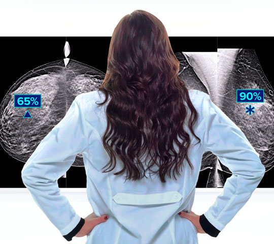 Hologic Genius AI™-detectietechnologie op witte achtergrond