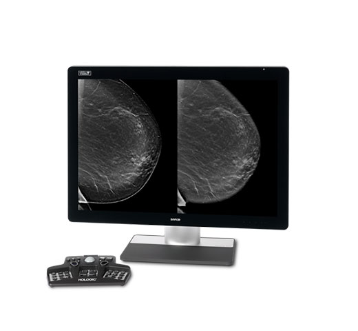 Hologic Intelligent 2D™ gesynthetiseerde beeldvorming op witte achtergrond