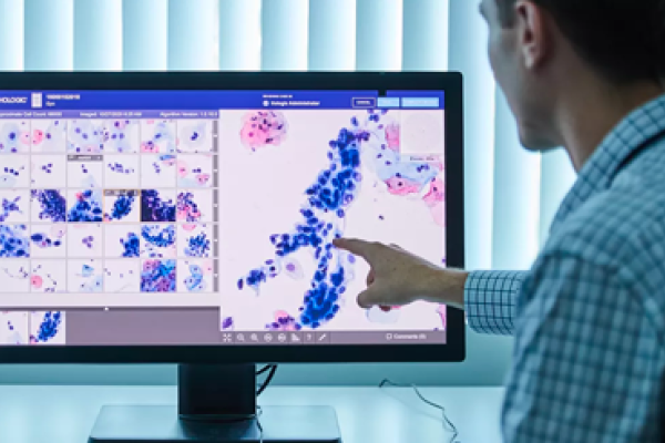 Zorgverlener bekijkt scanbeelden op beeldscherm