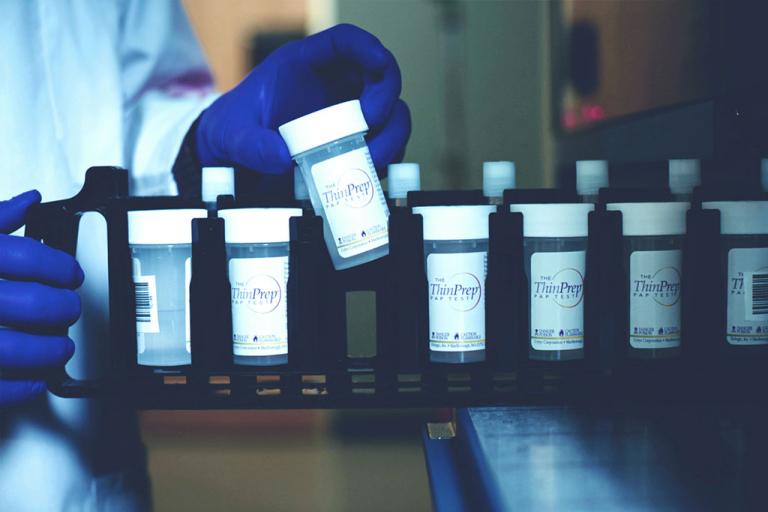 Hand met handschoen die monster uit tray haalt