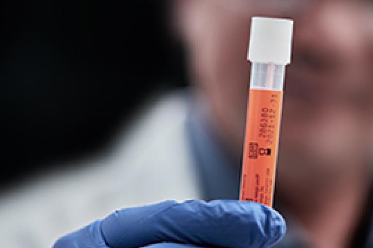 Gehandschoende hand die flacon vasthoudt