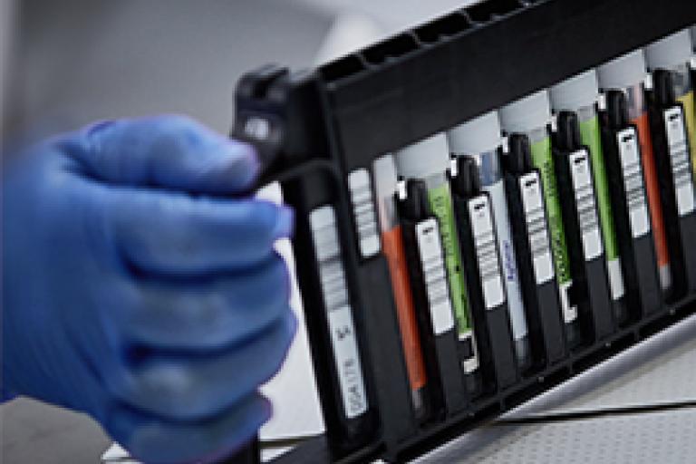 Gehandschoende hand met rek met flacons