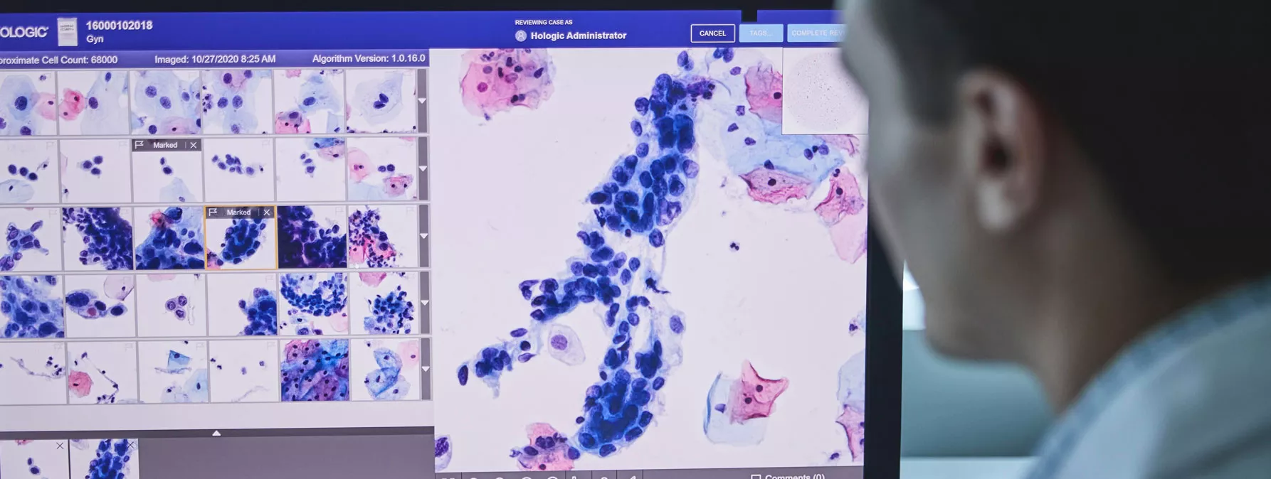 Afbeelding Genius™ digitaal diagnosesysteem
