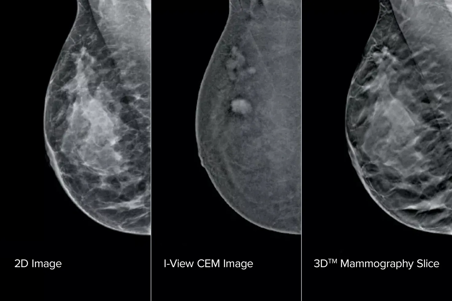 Borstbeeldvormingsscans