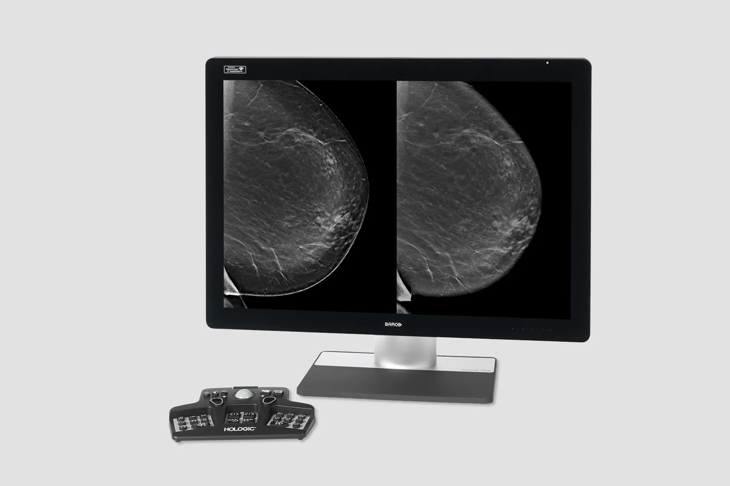 Röntgenbeeld van de borst