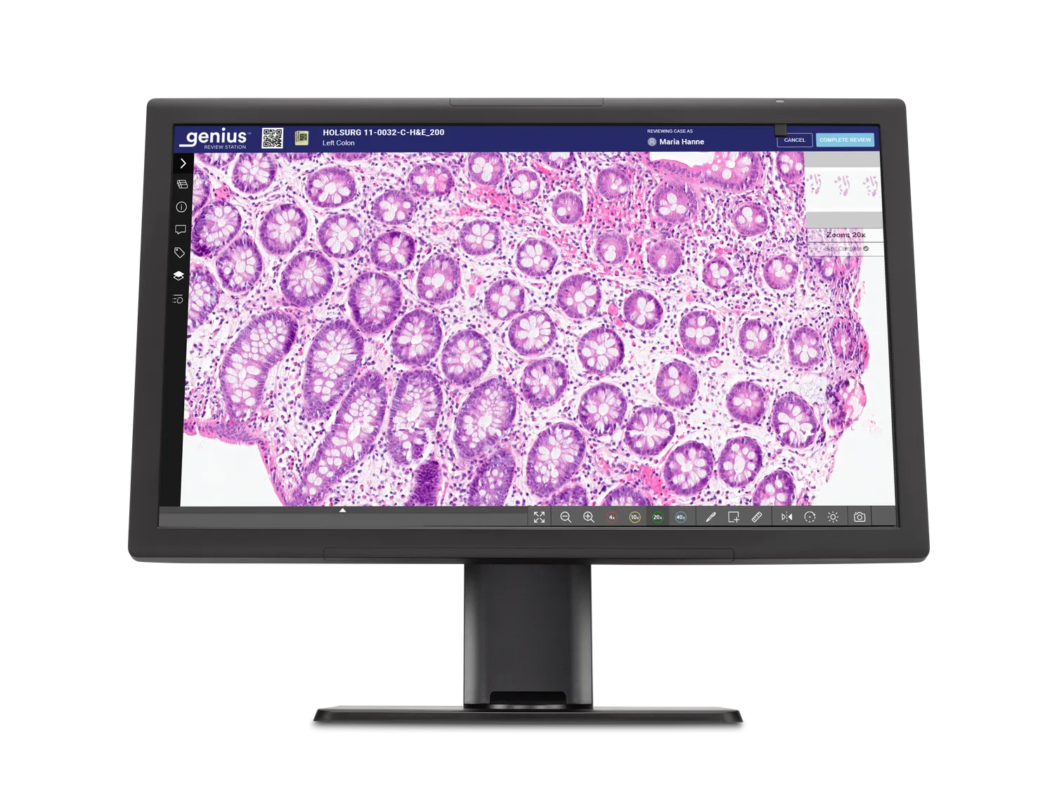 Genius-monitor toont histologiecellen klaar voor beoordeling