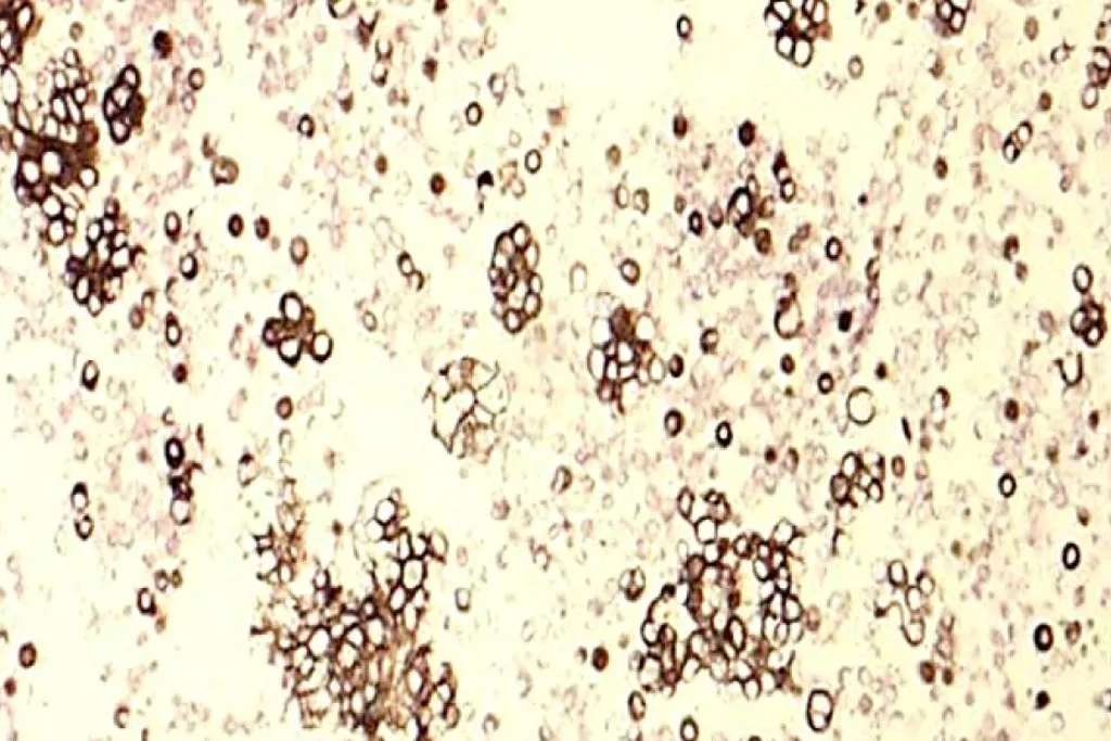 Cytokeratine 7​