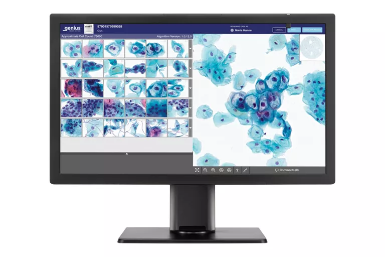 Afbeelding Genius-monitor