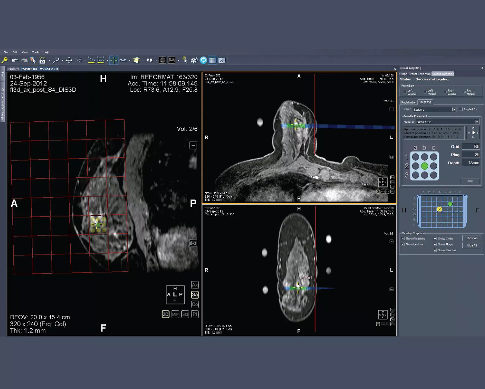 Screenshot MultiView