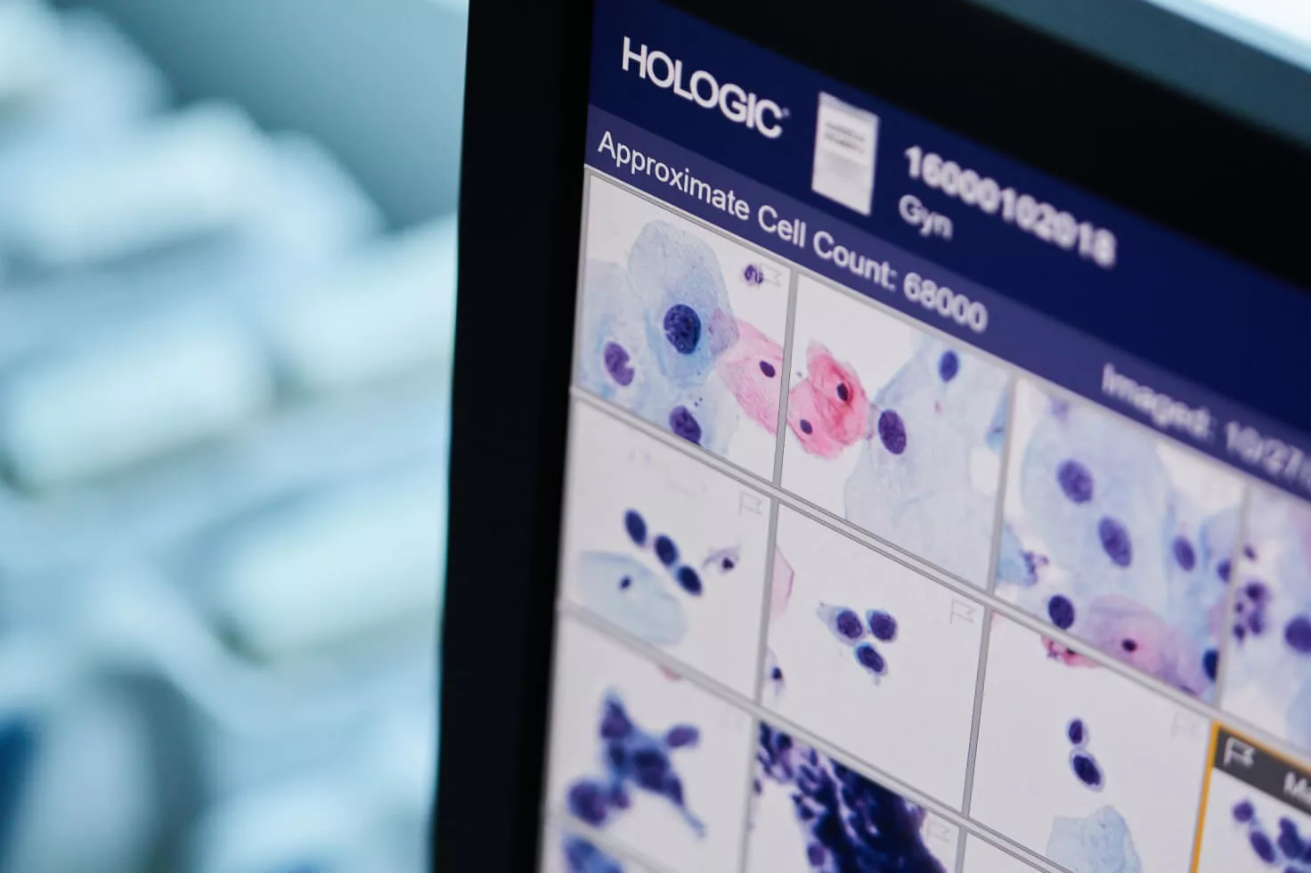 Close-up van monitorscherm gevuld met beeldscans met Hologic-logo in de hoek