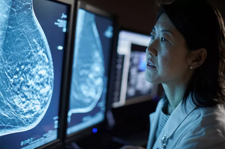 Zorgprofessional bekijkt röntgenbeelden op monitoren