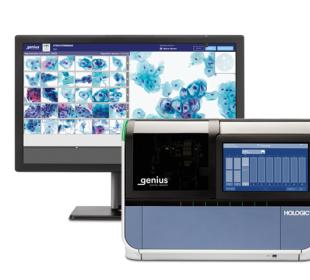 Hologic Genius™ digitaal diagnosesysteem op witte achtergrond