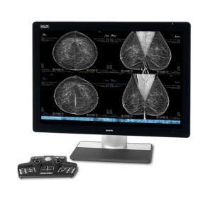 Hologic SecurView® borstbeeldvormingswerkstation op witte achtergrond