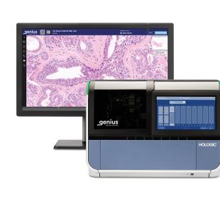 Imager en monitor van Genius digitaal diagnosesysteem laten baarmoederhalscellen zien